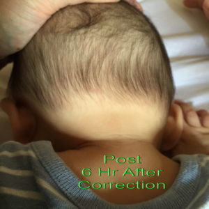 Infant-correction