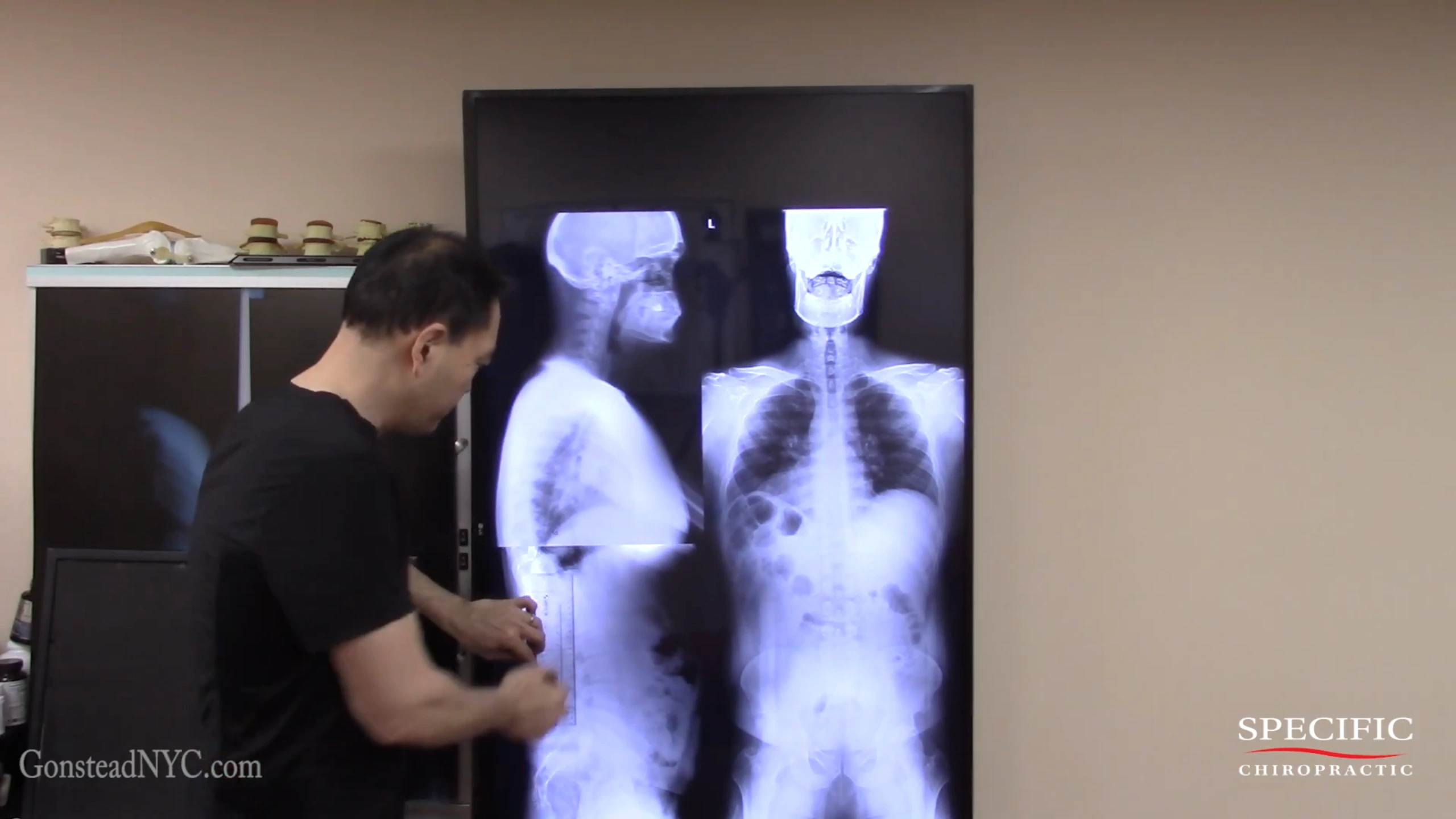 Gonstead X-Ray Analysis