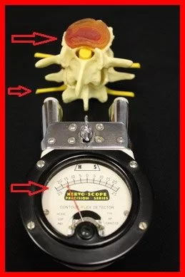 Structural Correction Manhattan 5 Abnormal Instrumentation Reading