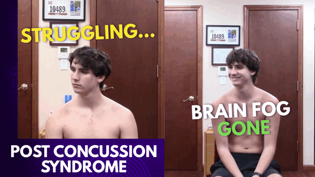 Teen athlete before and after Gonstead chiropractic adjustment showing recovery from post concussion symptoms—brain fog gone, mood lifted, and smiling confidently.